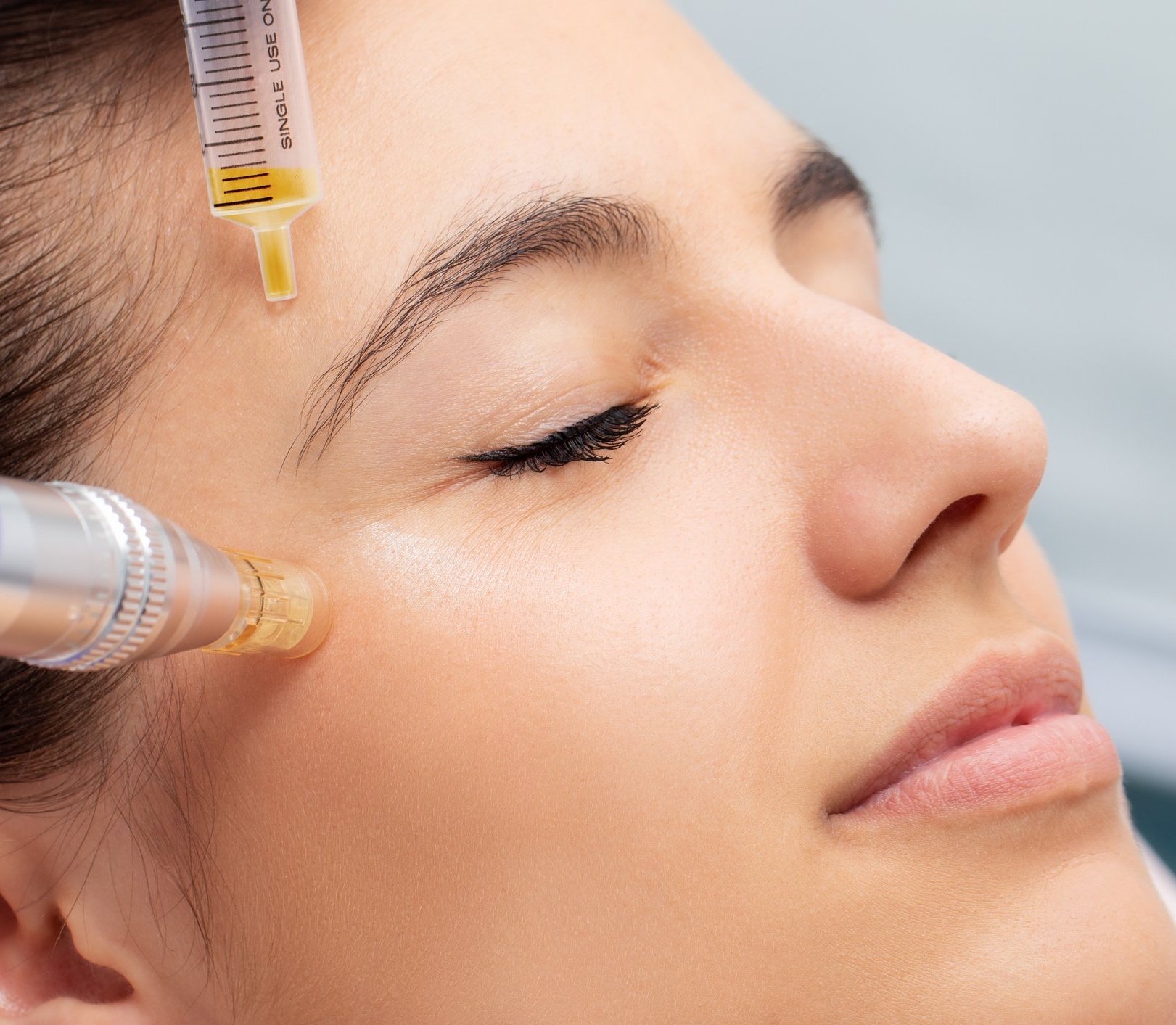 PRP Therapy Dubai